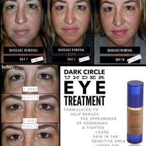 SeneGence Dark Circle Eye Treatment